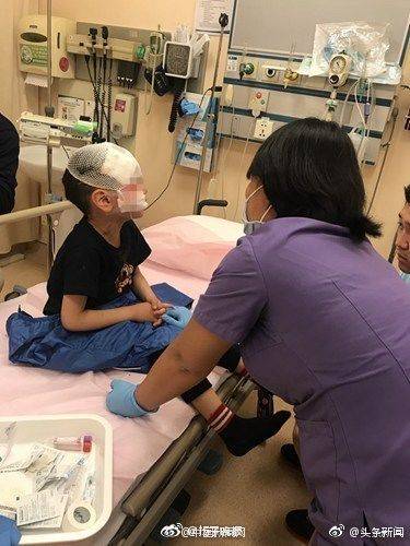 被咬死的孩子