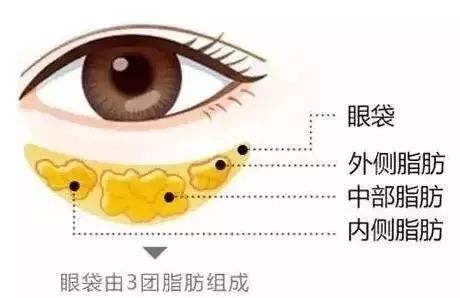 形成原因