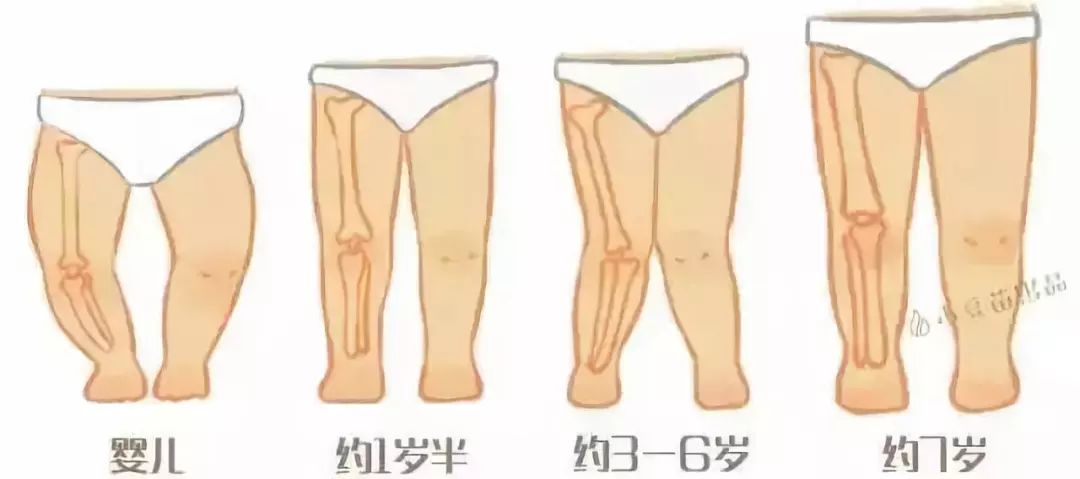 不绑腿宝宝长大容易变成O型腿？真相揭开后惊醒了无数家长…
