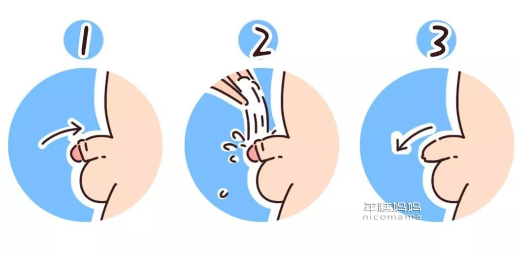 男宝要不要割包皮?几岁割?弄清楚这些很重要