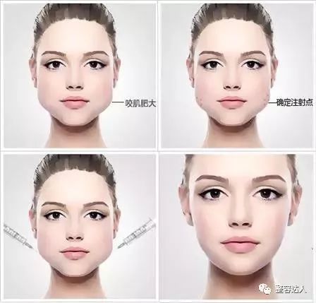 溶脂针和瘦脸针区别在哪里