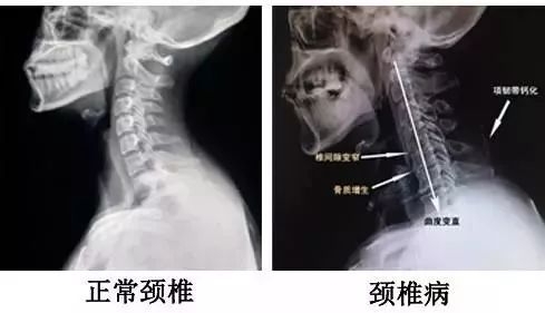 医生说,颈椎难受时用头在天空写个"粪"字!我竟然照着做了