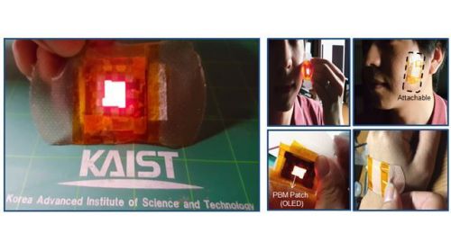 韩国研究员发明“OLED贴片” 利用光来治疗伤口