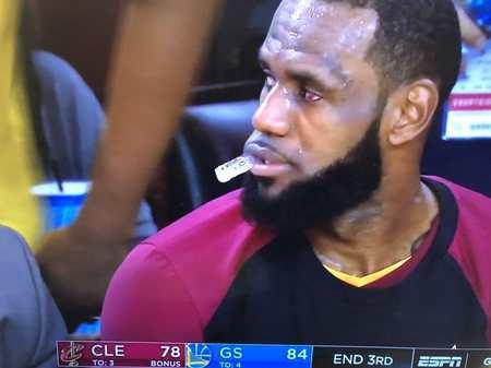 詹姆斯伤势图 VyFi-hcikcew0692429.jpg