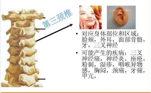 原来这些病源于"颈椎错位",对应图解值得收藏!