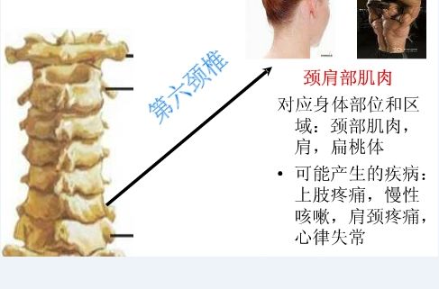 原来这些病源于"颈椎错位",对应图解值得收藏!