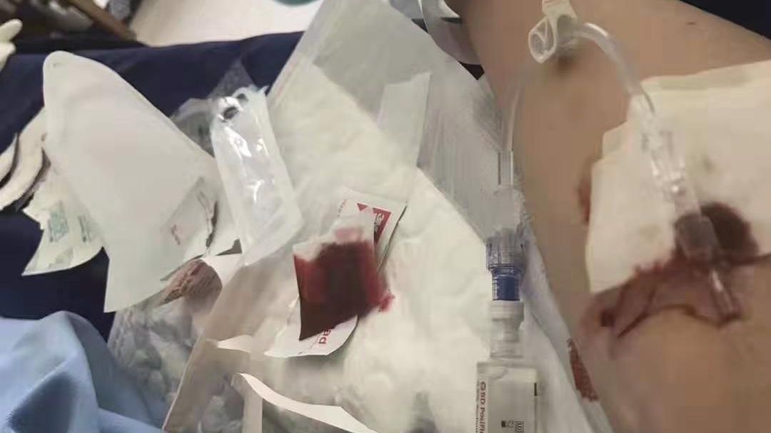 中国游客在泰撞礁石骨折 旅行社称有保险赴泰处理