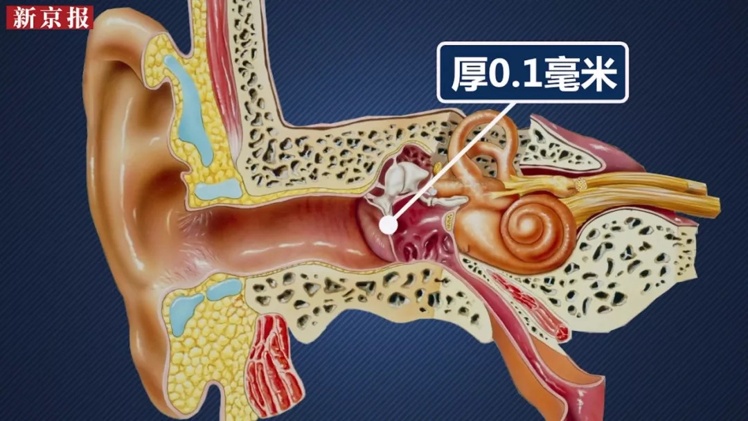 1毫米.亲吻时,耳孔形成负压能导致鼓膜穿孔.