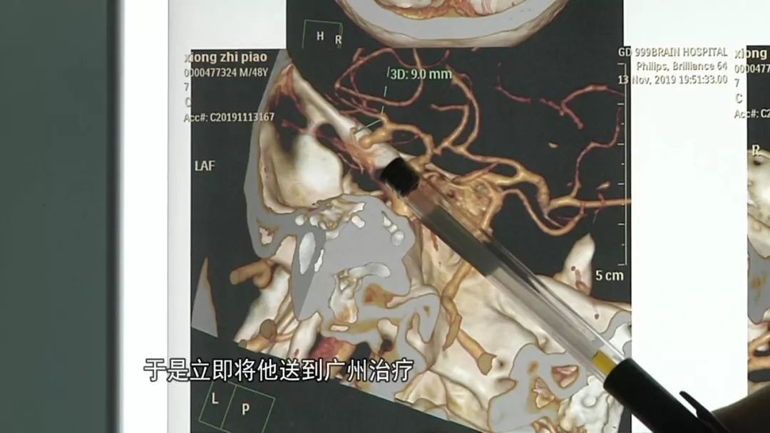 男子打麻将“打爆”脑的哥免费接送老人血管 医