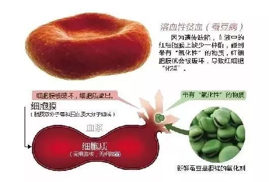 蚕豆病