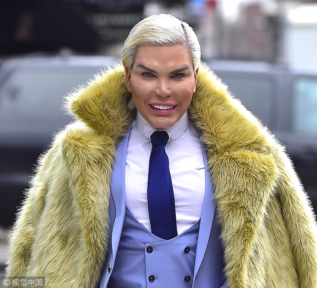 皮笑肉不笑!“肯娃娃”罗德里戈现整容后遗症 西装披皮草大衣霸气