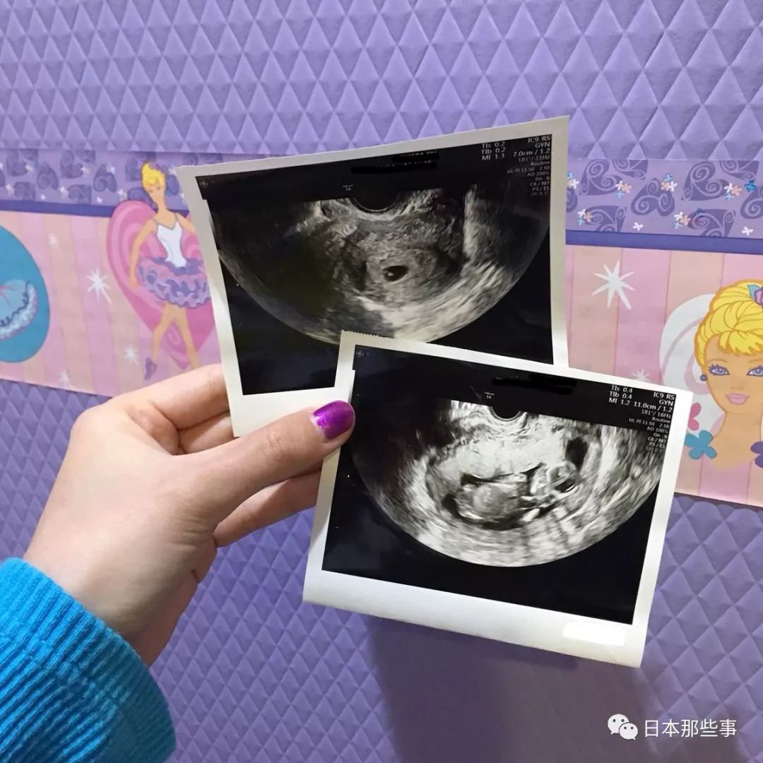 日本网红95后明星夫妇要有孩子了 进度也是很快!