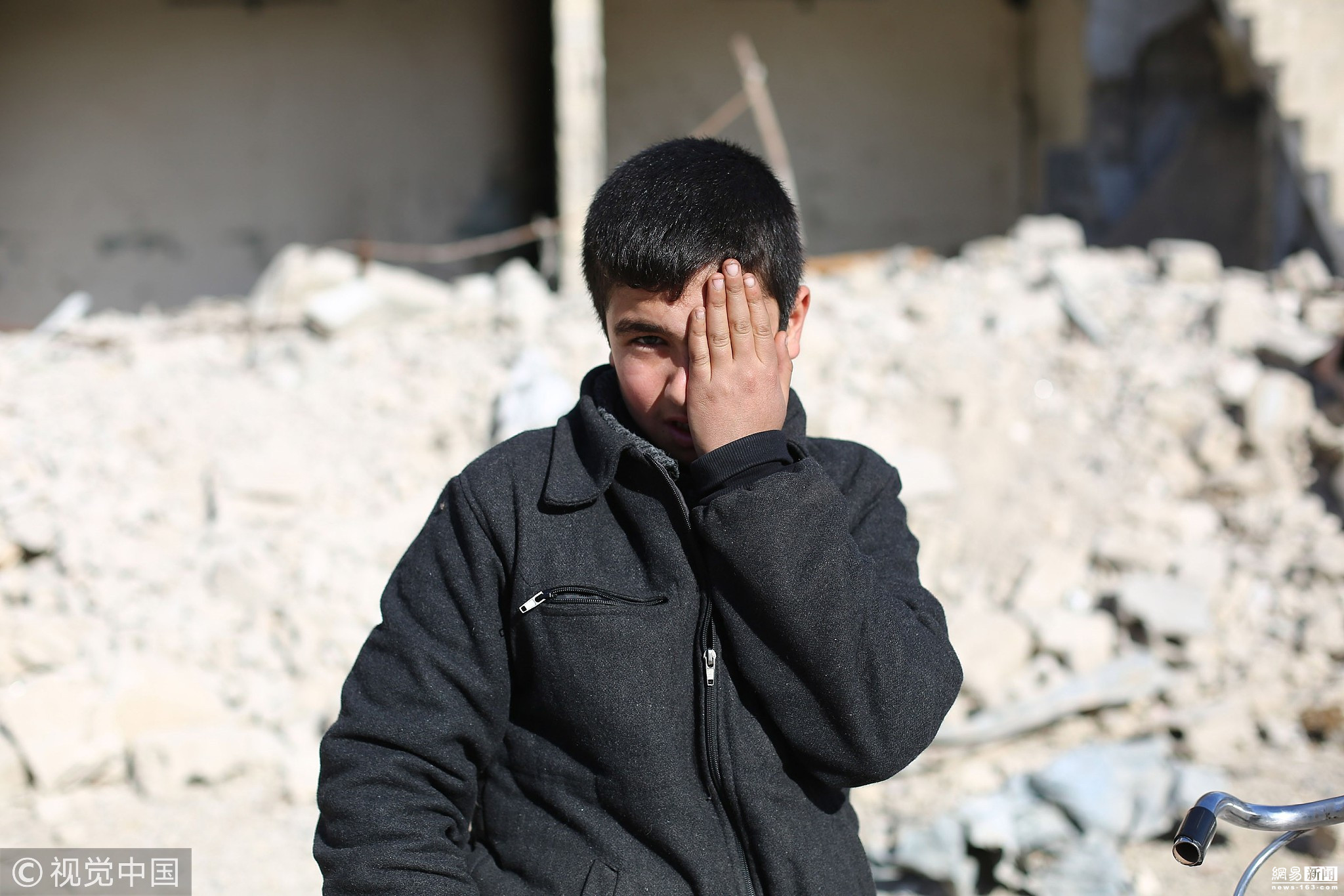 叙利亚战争群像:声援失去眼睛的孩子