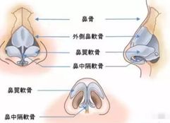 鼻翼软骨