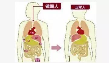 △镜面人内脏图像