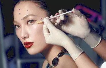 注射除皱