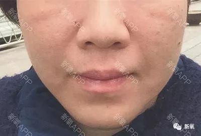 原来章子怡频繁进出整形医院是为了掩饰这个!