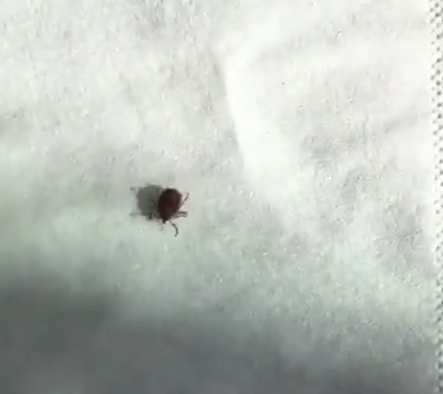 遛狗后手腕红肿 被蜱虫咬伤 惊蛰一过 记得给宠