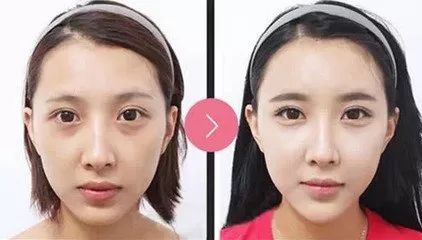 案例