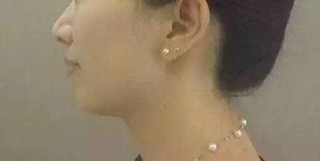 下巴