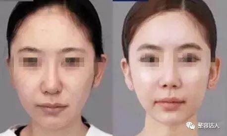 对比