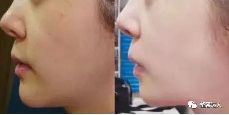对比