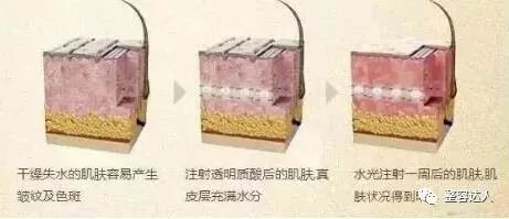 组织