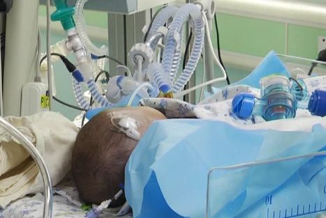 1岁半幼童吃开心果卡喉窒息,这种东西不要再给