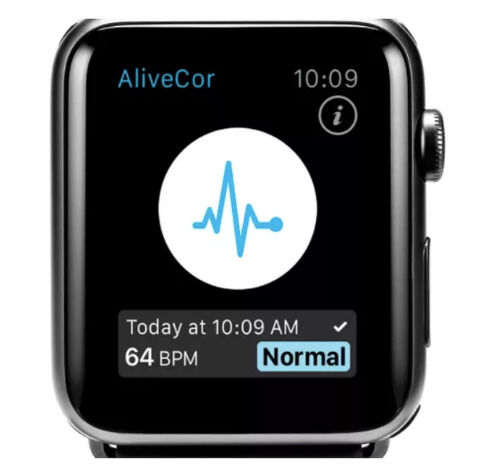 Apple Watch腕带传感器声称可以检测血液中的钾