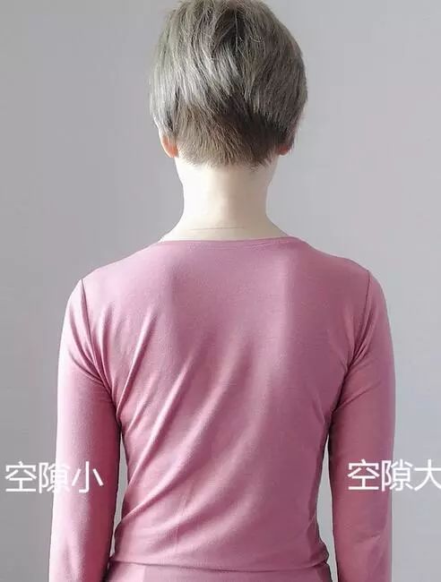是不是高低肩.