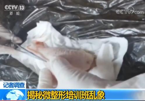 鸡腿联系