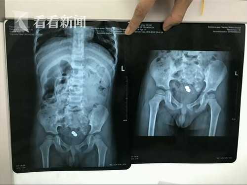 视频|小狗误将男童塞进视频a视频家长让其狂吃肛门鬼哭夜图片