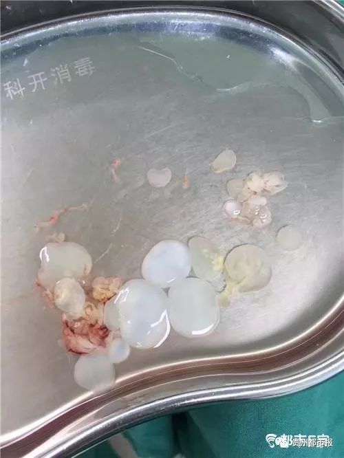 Ӵȡ30棡ҽû⣬