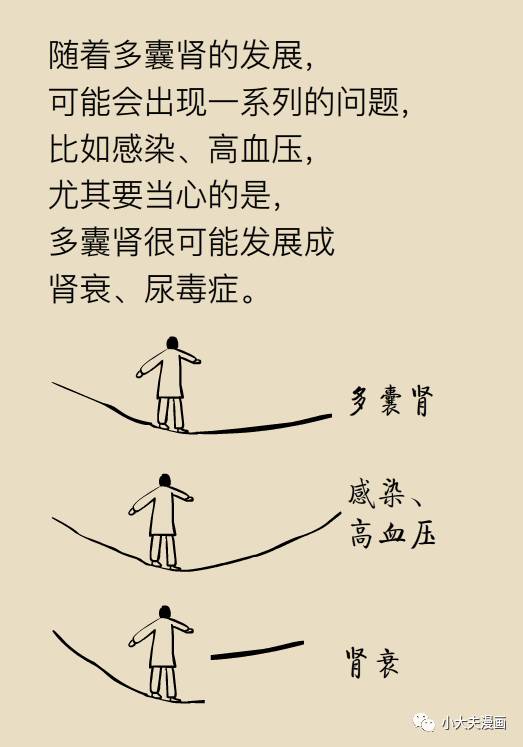 肾囊肿是个什么情况？北大教授来科普