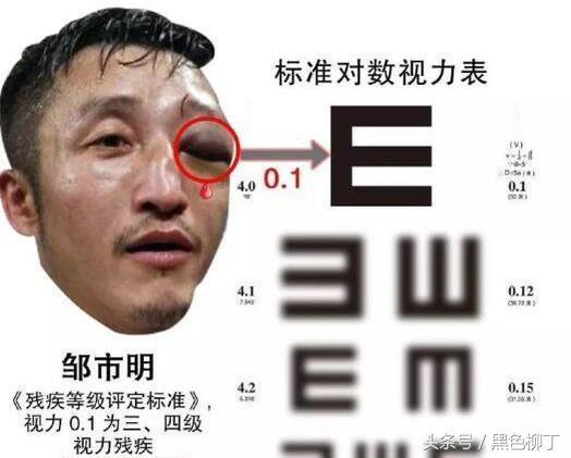 中国又一顶级巨星濒临退役? 邹市明该怎么评价