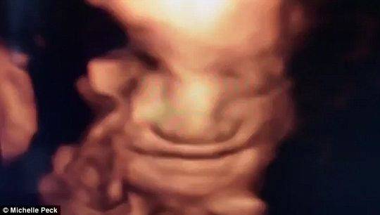 封面新闻:英国孕妈做四维彩超检查 拍到宝宝咧嘴微笑(图)