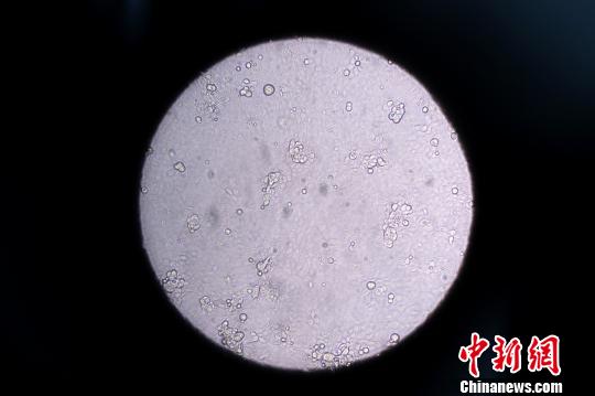 图为被流感病毒感染的人体细胞。 韦亮 摄