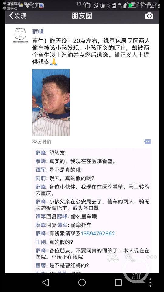 新浪综合:重庆8岁男童疑因阻偷车贼遭报复 头部被泼油点火