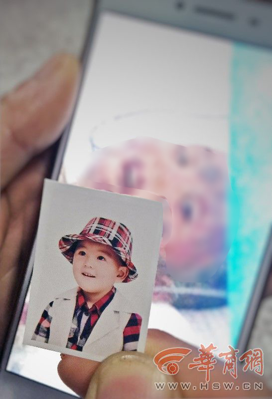 妈妈给两儿子洗澡用甲醇取暖突发爆炸，小儿子被烧得体无完肤