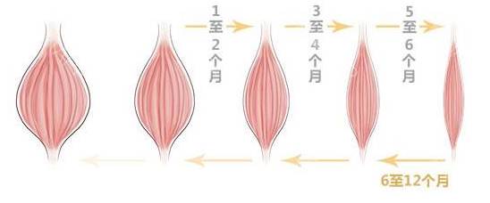 如何防止打完瘦脸针面部僵硬、凹陷?|肉毒素|外