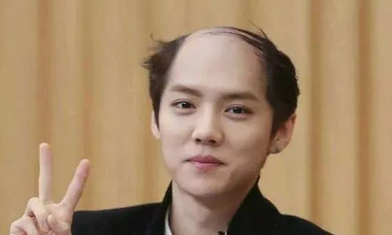 脱发的人更长寿上热搜!网友评论笑哭:秃着活