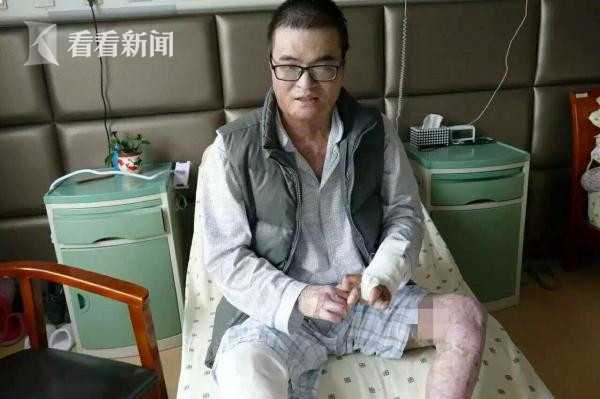 救火英雄王海滨完成最后一次康复手术,回归社会进入倒