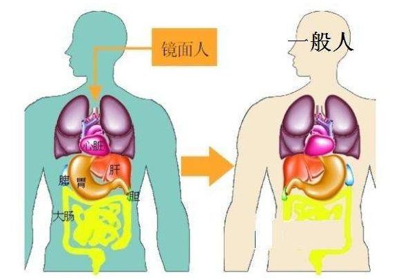 100万人中才有可能出现1例！哈尔滨“镜面人”母亲，8小时产下健康女婴！