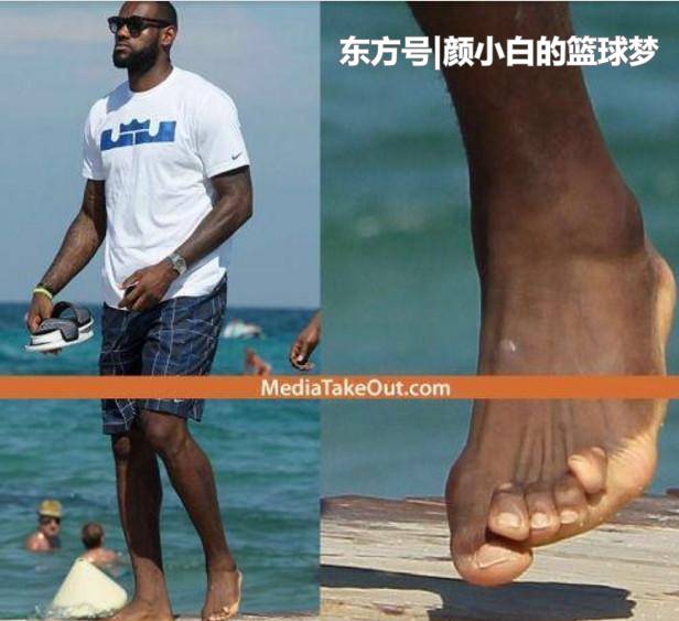 nba球星脚趾都畸形,nba球员脚趾畸形