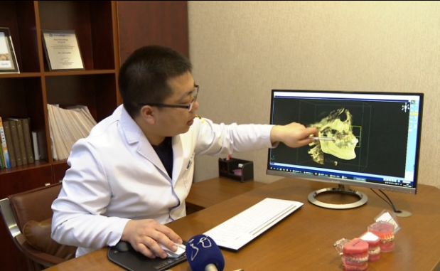 长颗智齿后,她右侧下牙越来越拥挤,一刷牙就出