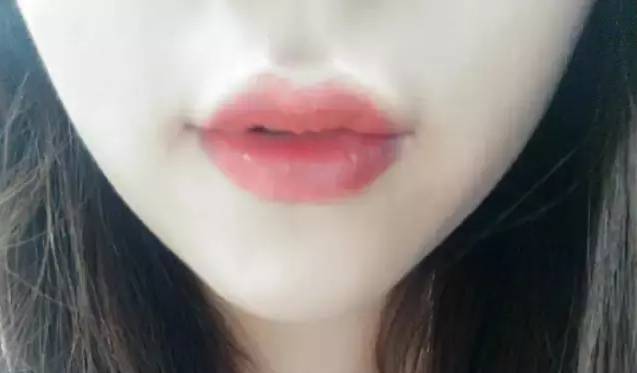 注射