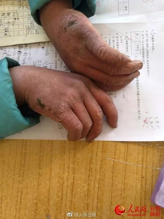 云南昭通冰花男孩冒冰霜上学造型走红网友好心疼