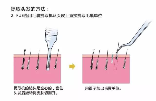 方法