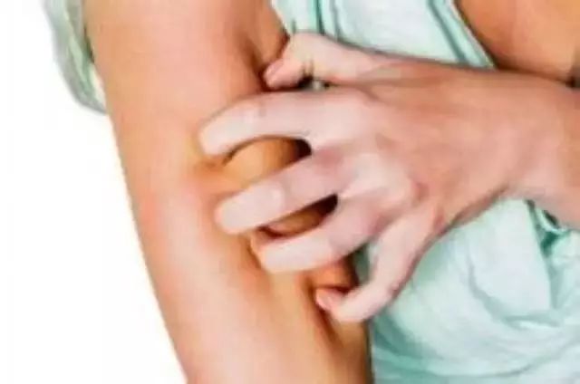 女性左侧腰酸痒，女性左侧腰酸痒怎么回事-第2张图片-Otaku Male Knowledge
