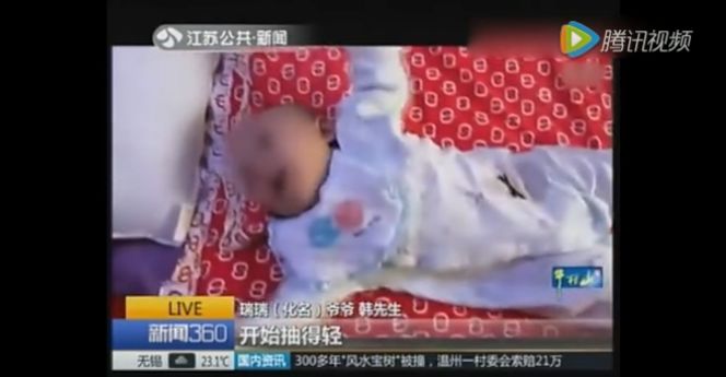 多名婴儿突然脑出血 家人到医院检查后被吓惨